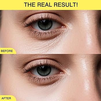 The Vita A Retinal Shot Tightening Booster